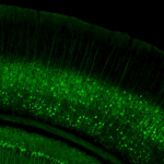 Fezf2-CreER;Ai148(TIT2L-GC6f-ICL-tTA2) fluorescence expression