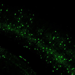 Pvalb-IRES-Cre;Ai162(TIT2L-GC6s-ICL-tTA2) fluorescence expression