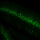 Scnn1a-Tg3-Cre;Camk2a-tTA;Ai93(TITL- GCaMP6f) fluorescence expression