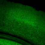 Slc17a7-IRES2-Cre;Camk2a-tTA;Ai94(TITL-GCaMP6s) fluorescence expression