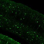 Sst-IRES-Cre;Ai148(TIT2L-GC6f-ICL-tTA2) fluorescence expression