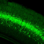 Tlx3-Cre_PL56;Ai148(TIT2L-GC6f-ICL-tTA2) fluorescence expression