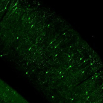 Vip-IRES-Cre;Ai148(TIT2L-GC6f-ICL-tTA2) fluorescence expression